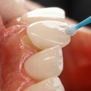 kamal-hoseinianzade-FCWGwXH55xo-unsplash kamal-hoseinianzade-FCWGwXH55xo-unsplash