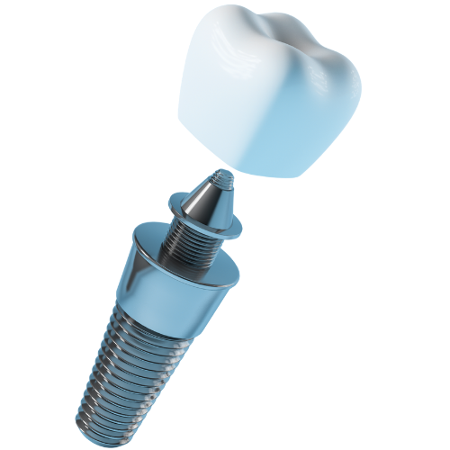 silk dental implant website 01