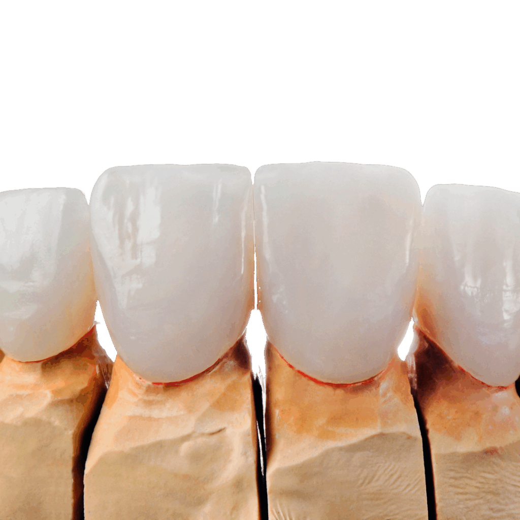 silk-services-veneers-main