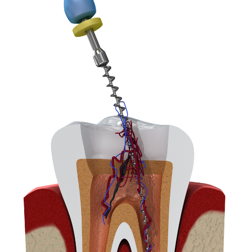 silk website root canal 01